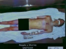 Warning: Graphic Michael Jackson Autopsy Photo